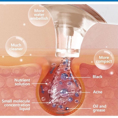 جهاز الهيدرافيشل المنزلي ذو التنظيف العميق - Makfool