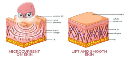 جهاز مساج بتقنية مكركرنت لتحفيز الكولاجين وشد البشرة - Makfool