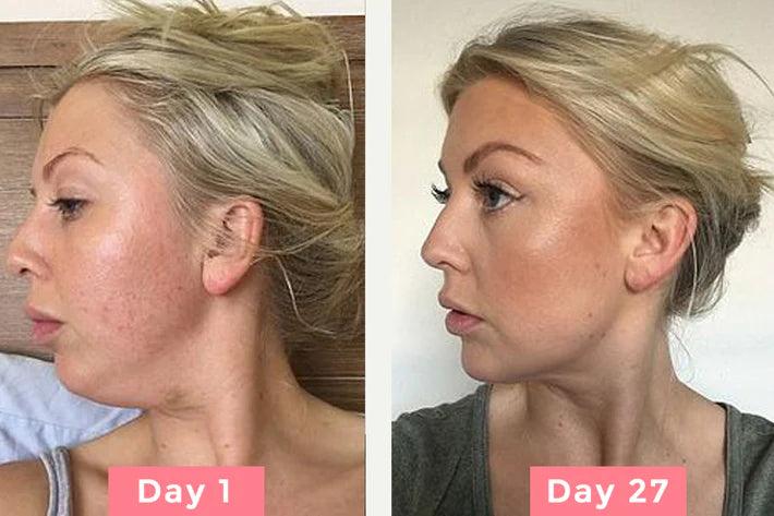 جهاز رفع وشد تجاعيد الوجه والرقبة - Makfool